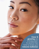 Nuria Rescue Pore-Minimizing Toner - Clear & glowing skin is finally here! An alcohol-free toner to reveal your natural radiance!